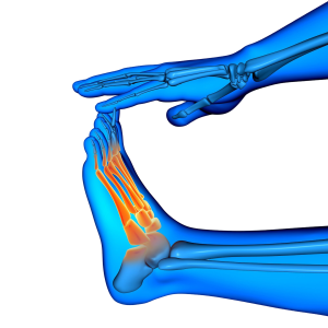 Rheumatoid Arthritis Product image